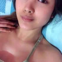 hazel