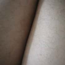 kabo