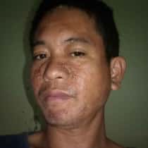 Tony Bhoy ii